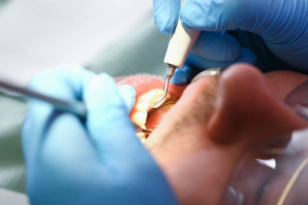 Best Emergency TMJ Treatment in Cahokia, IL