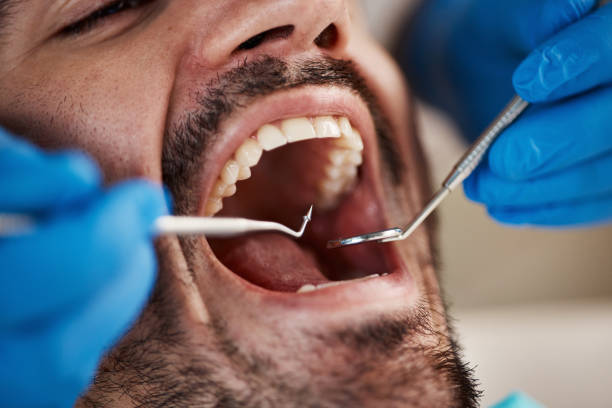 Best Urgent Care for Lost Fillings or Crowns in Cahokia, IL